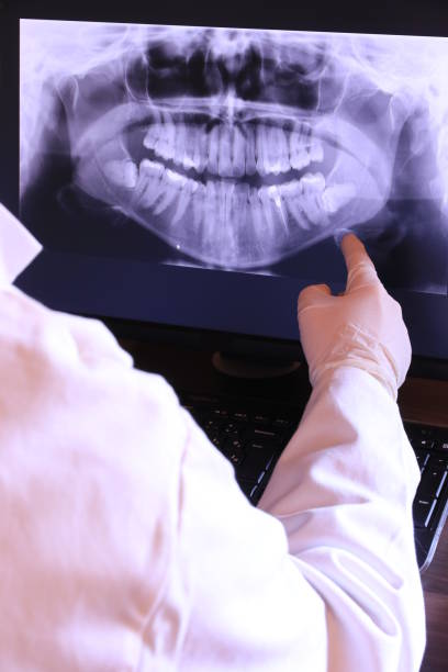 Best Emergency Tooth Extraction in North Canton, OH